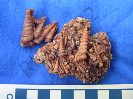 Gastropod